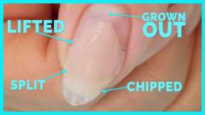 Fix Broken Gross Nail WITHOUT Removing It All!