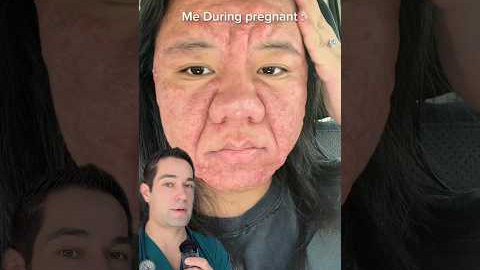 How pregnancy affects your looks